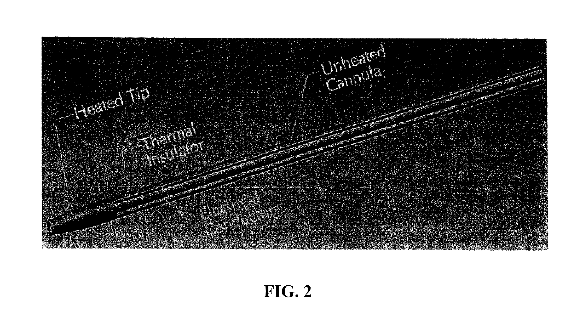 Heated tip implant delivery system