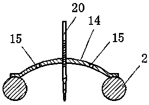 Traction and reduction frame for calf and ankle fractures