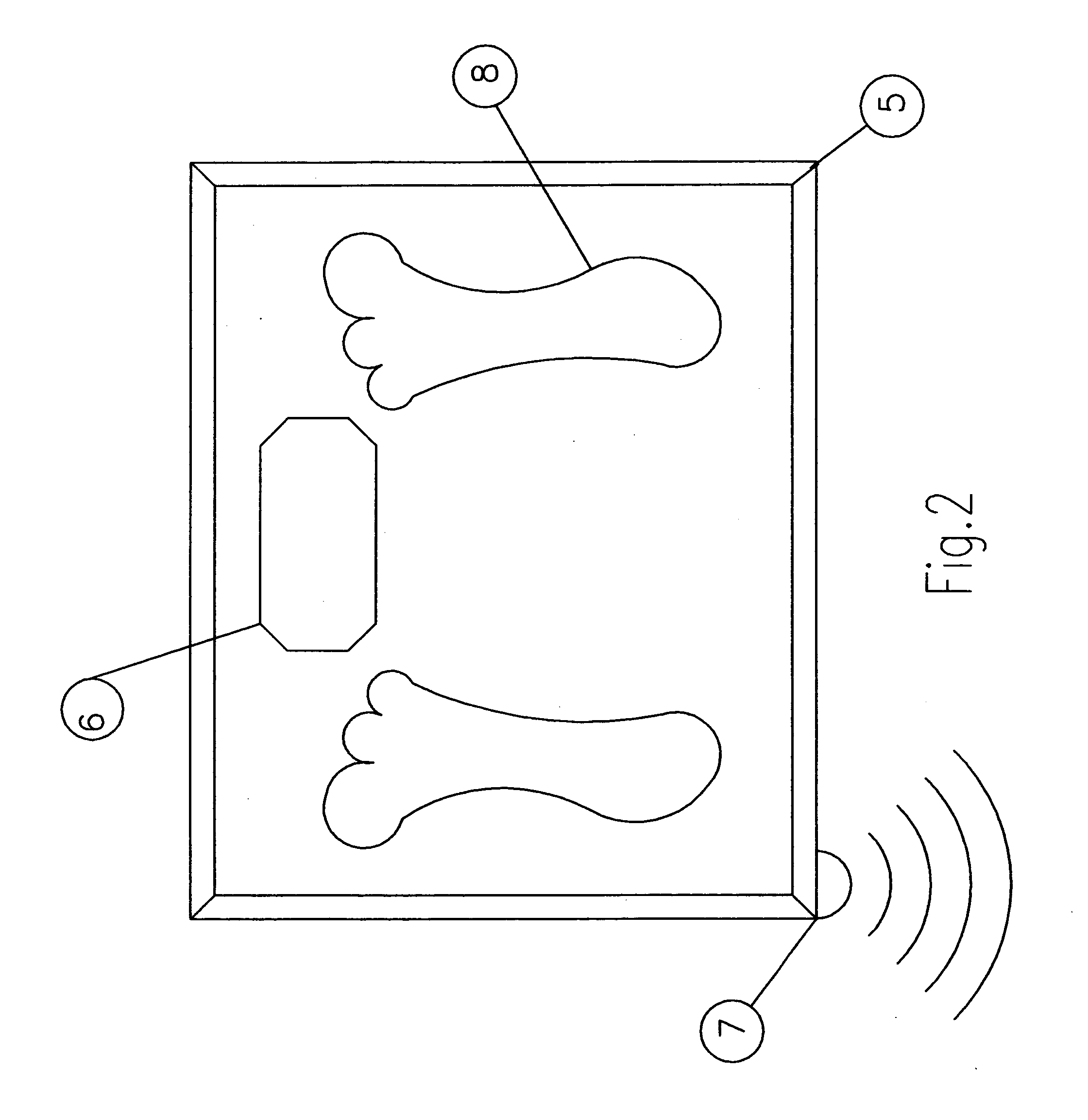 Remotely controlled weight scales