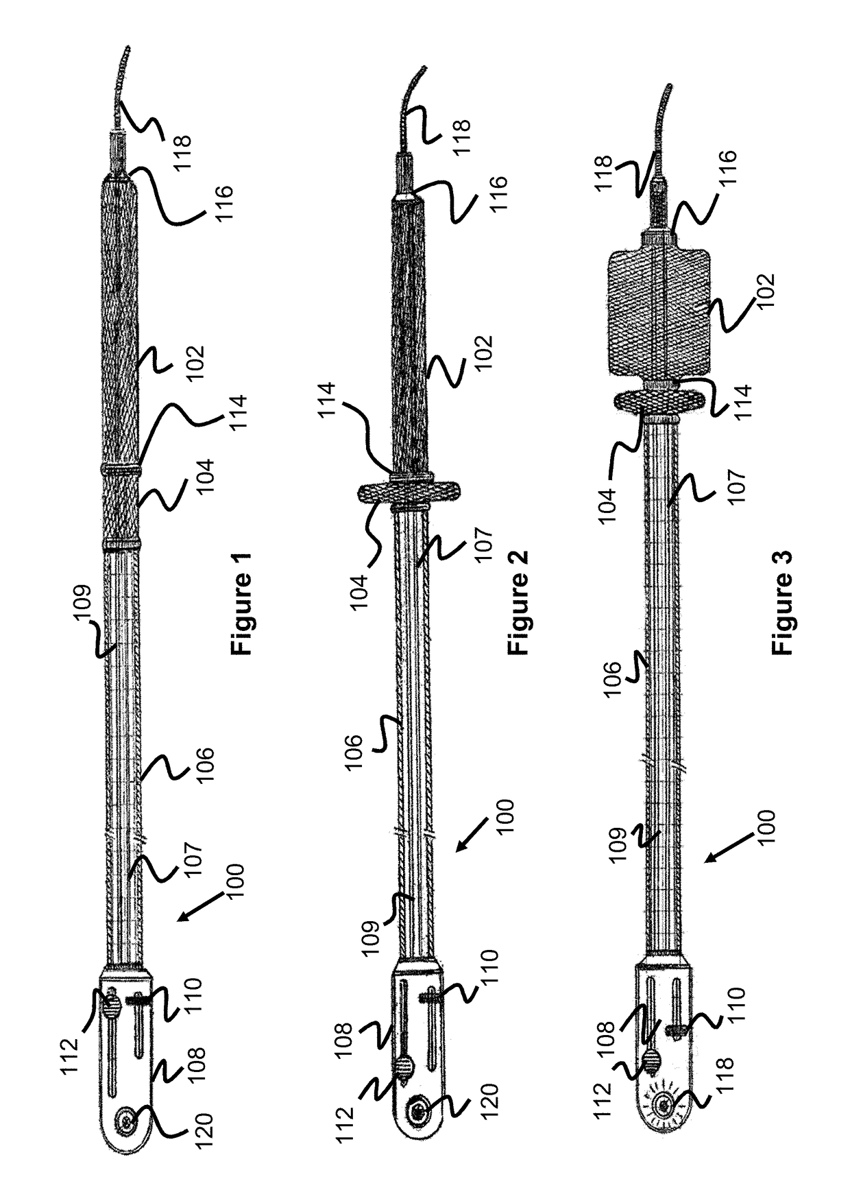 Temporary Aortic Occlusion Device