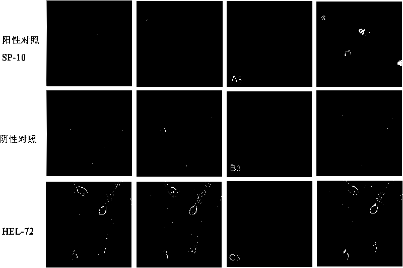 Human epididymis expression sperm binding protein HEL-72, encoding gene and application thereof