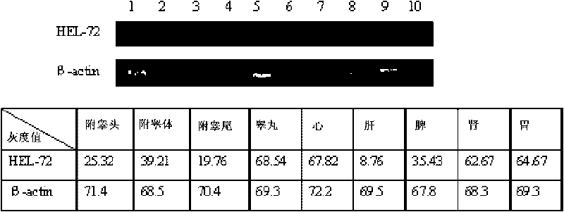 Human epididymis expression sperm binding protein HEL-72, encoding gene and application thereof