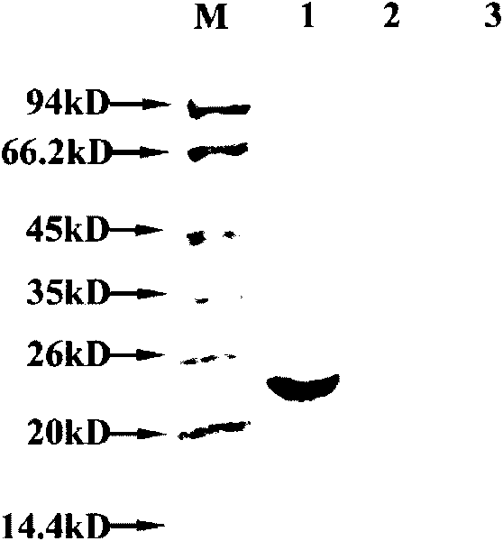 Human epididymis expression sperm binding protein HEL-72, encoding gene and application thereof