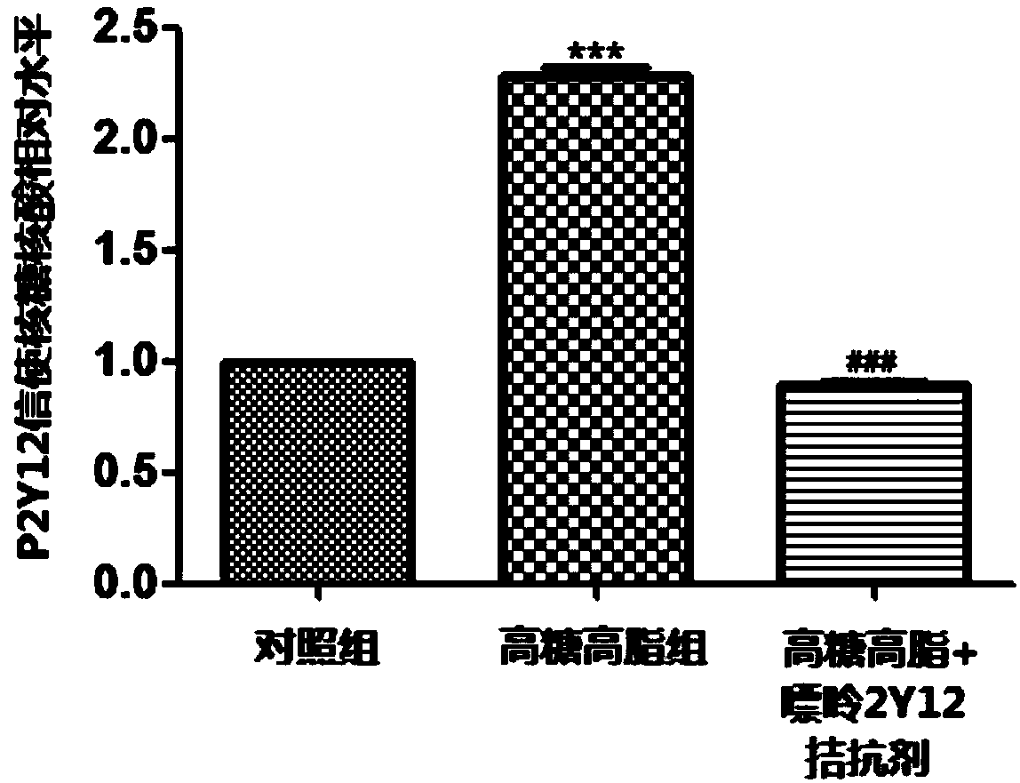 Application of purine 2Y12 receptor antagonist in preparing medicine for diabetic neuropathological injury diseases