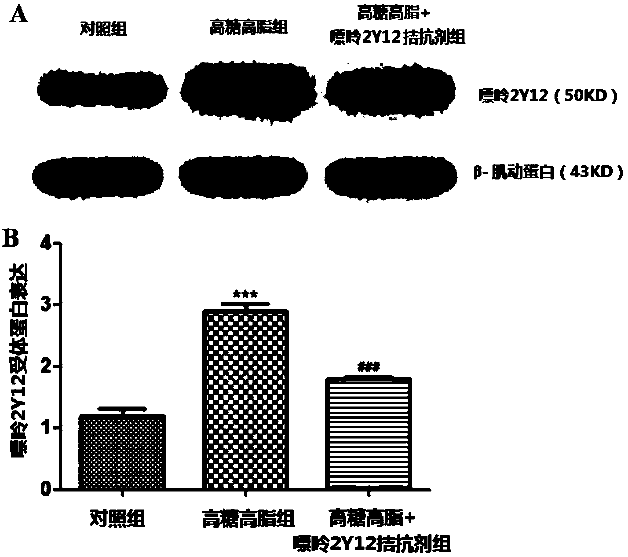 Application of purine 2Y12 receptor antagonist in preparing medicine for diabetic neuropathological injury diseases