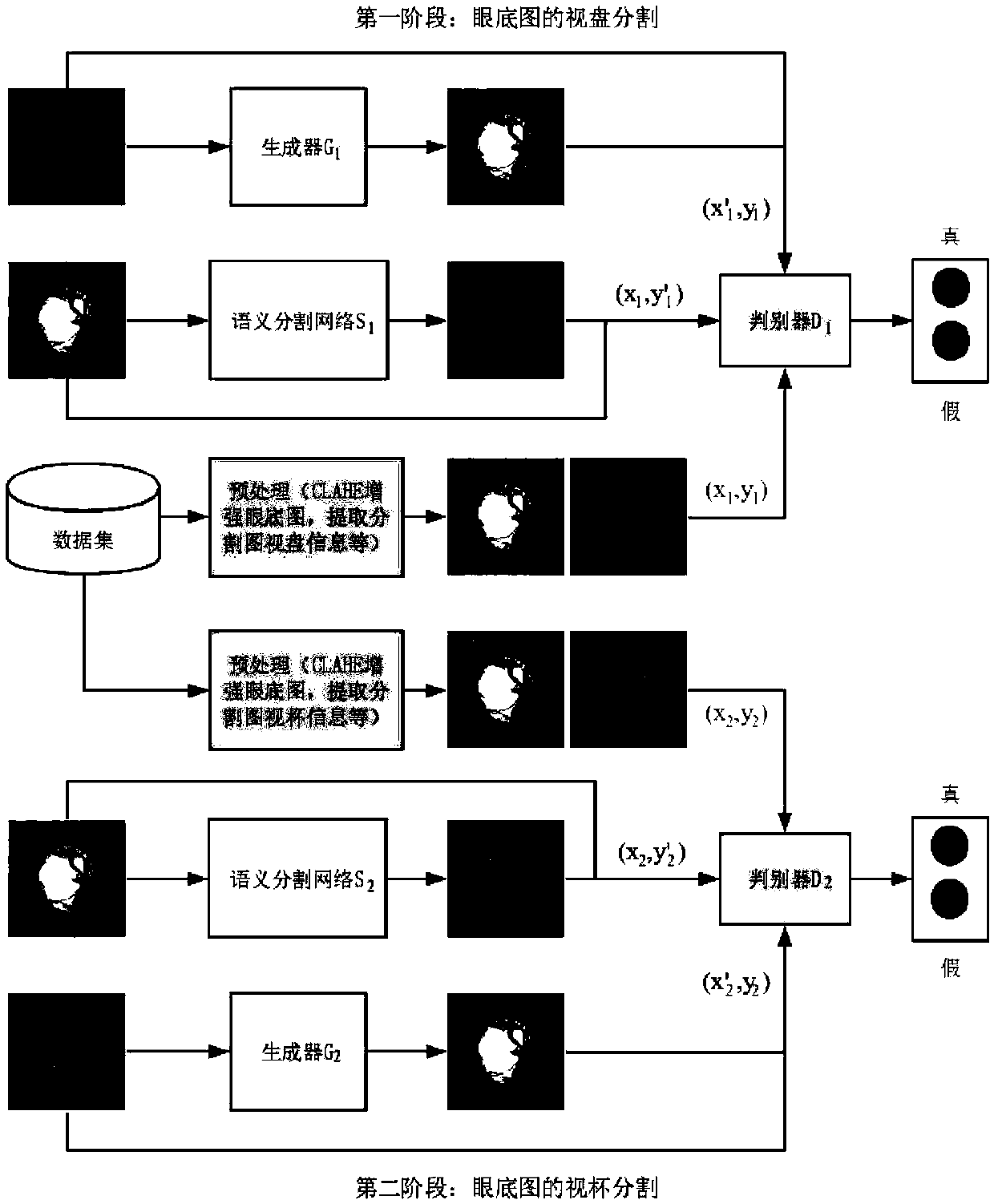 Fundus image optic disc and optic cup segmentation method based on a semi-supervised conditional generative adversarial network