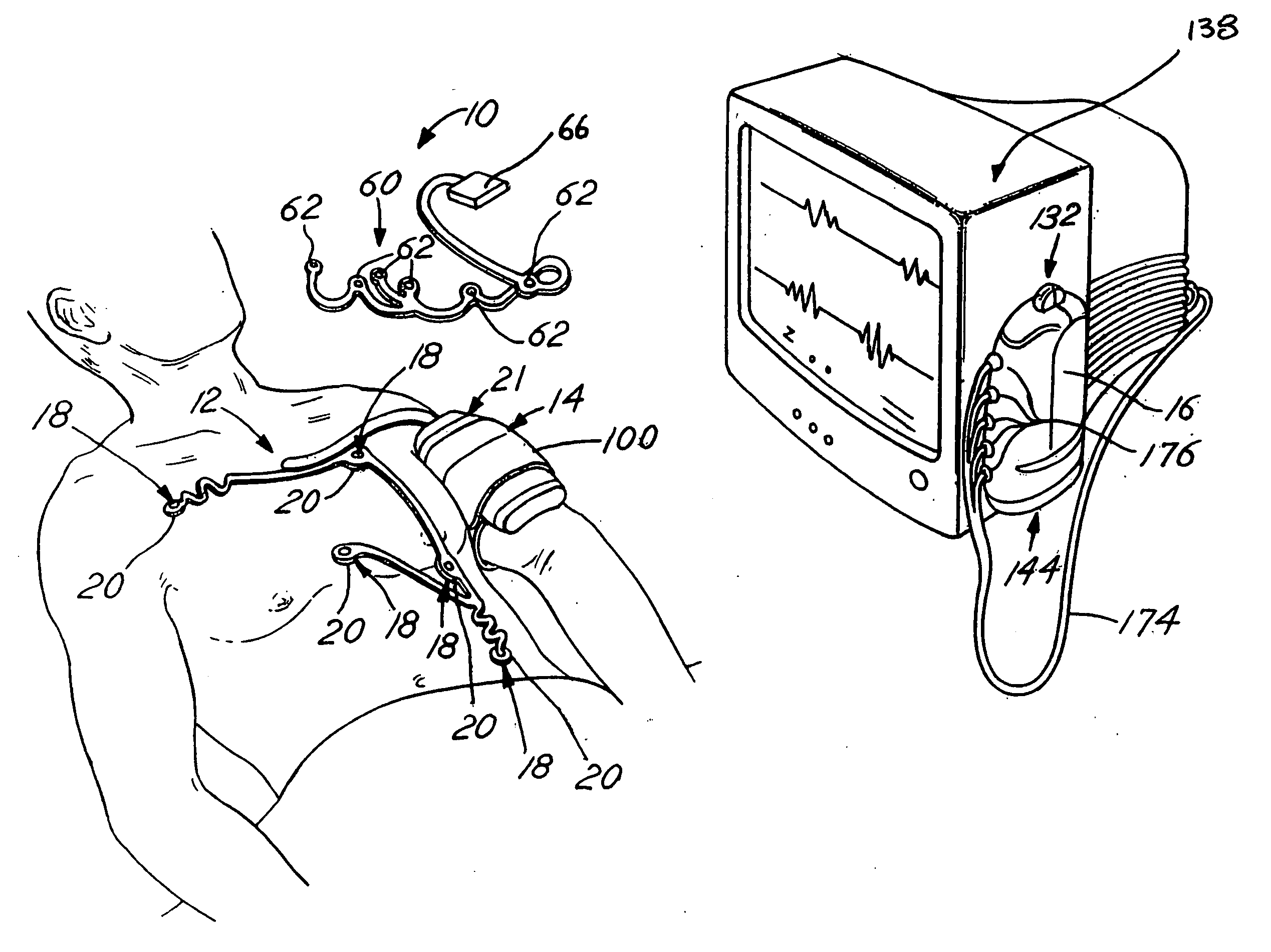 Disposable chest assembly