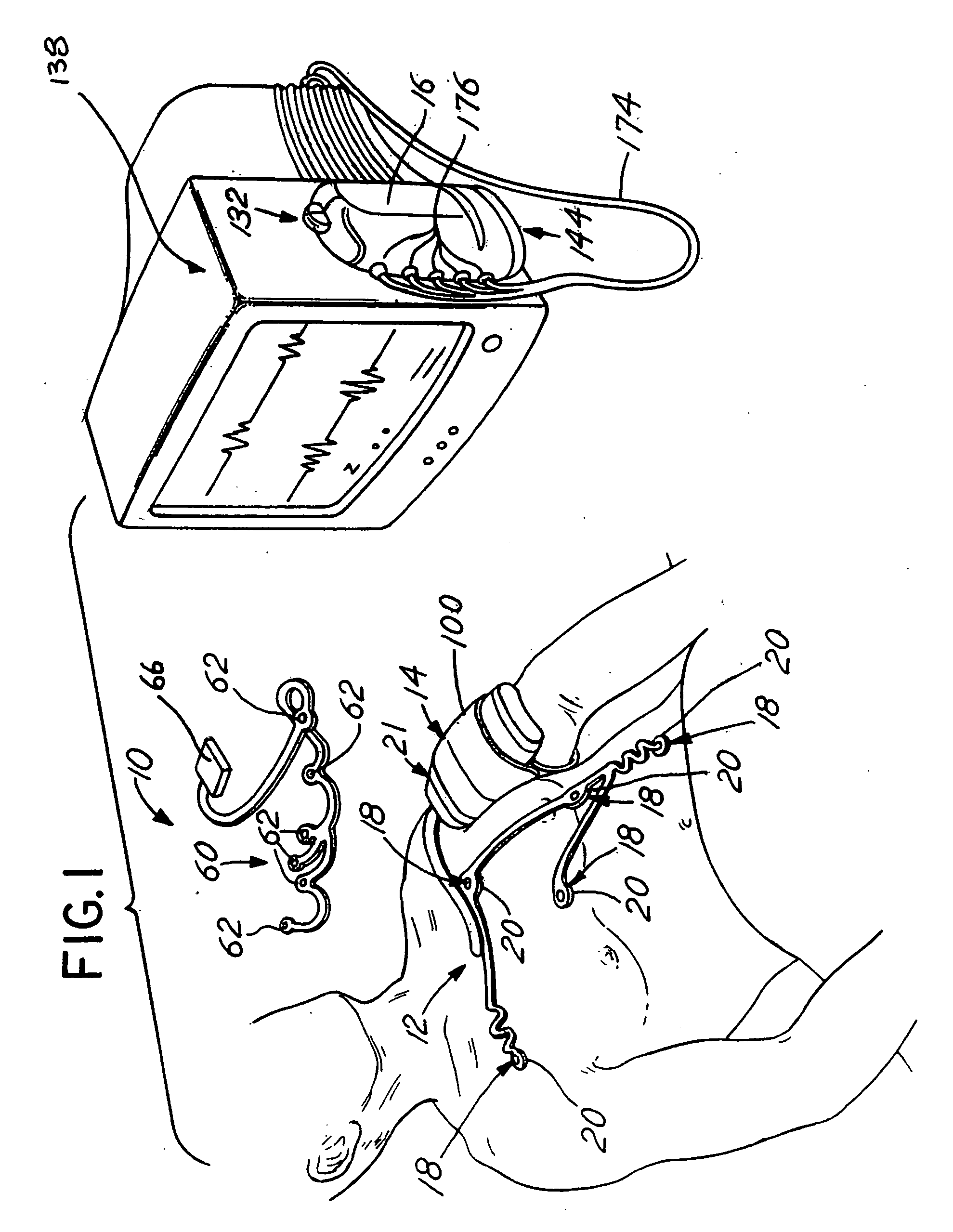 Disposable chest assembly