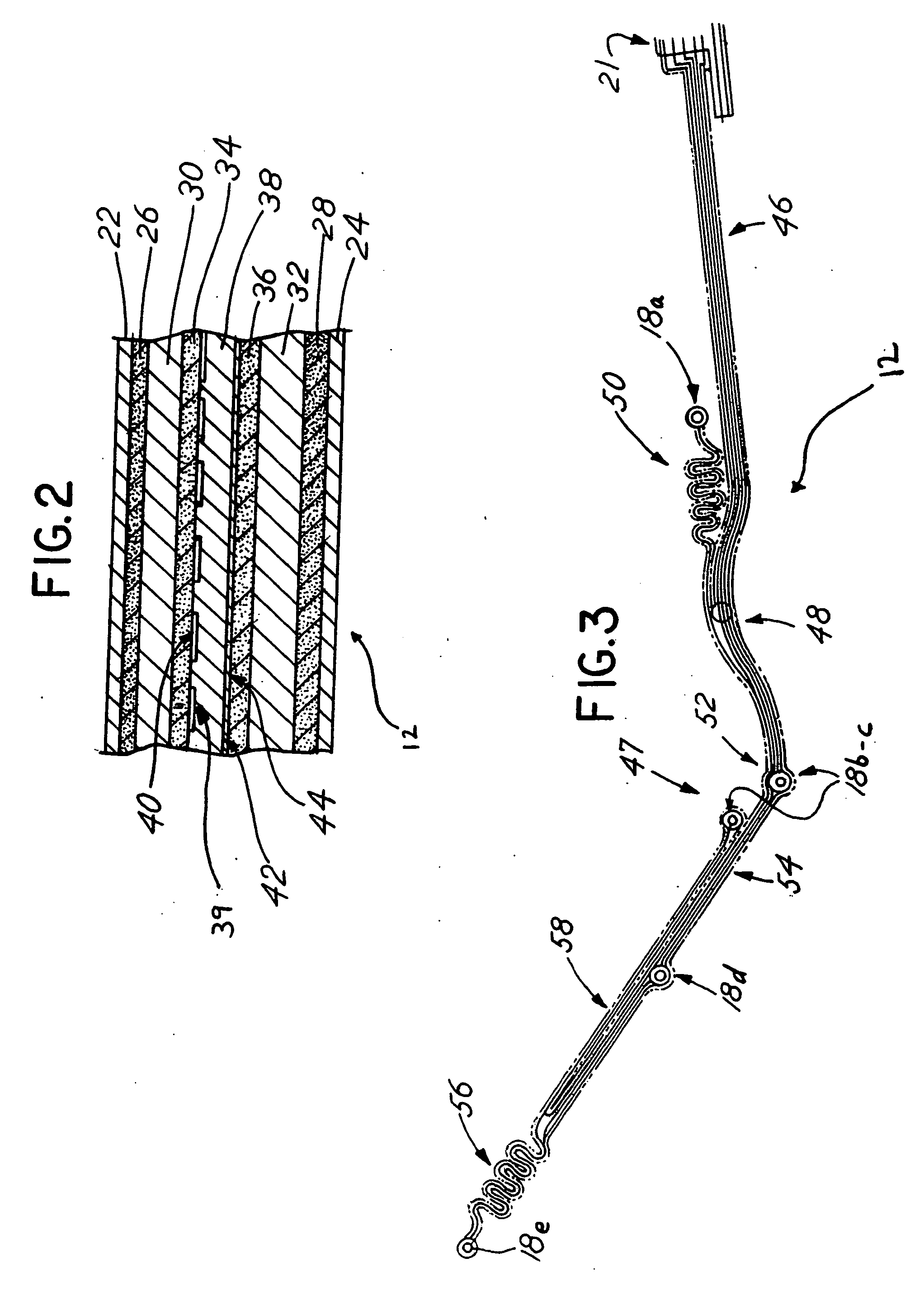 Disposable chest assembly