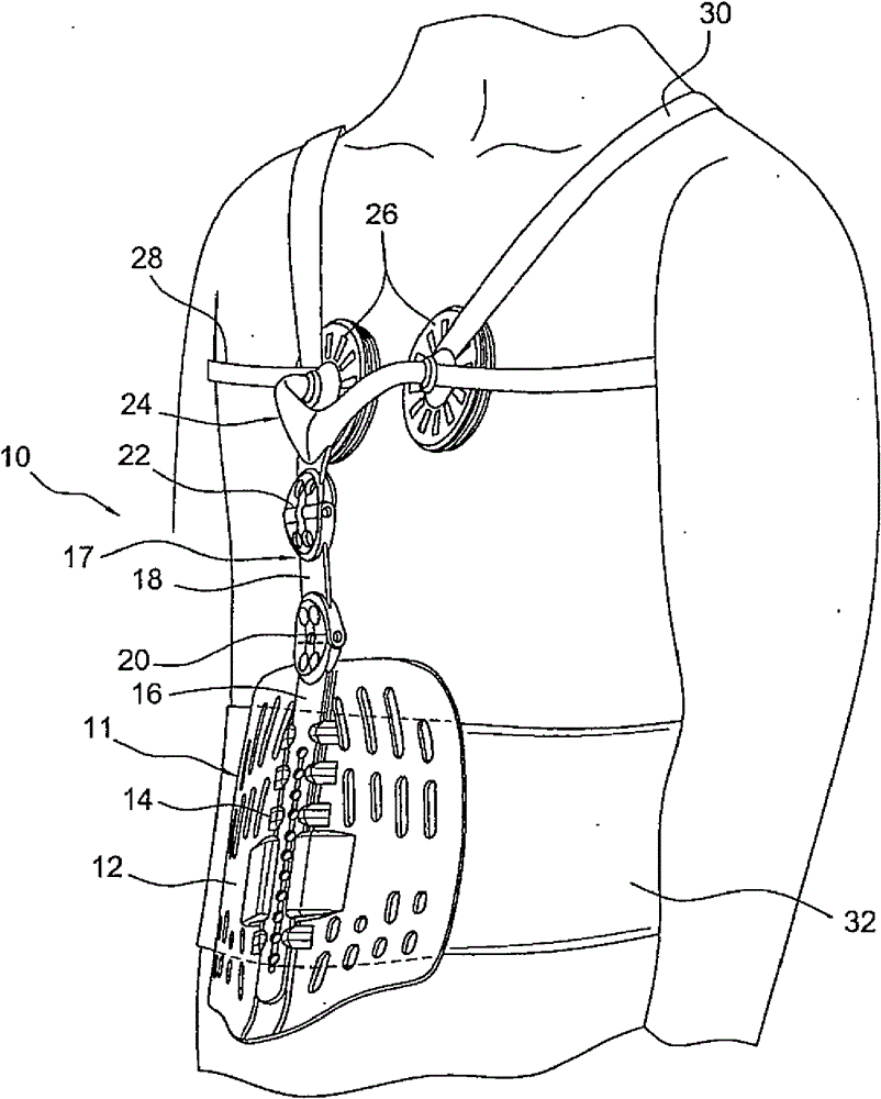 Thoracic lumbar sacral orthosis