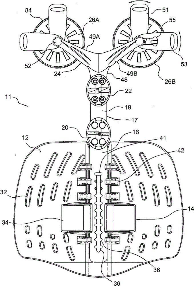 Thoracic lumbar sacral orthosis