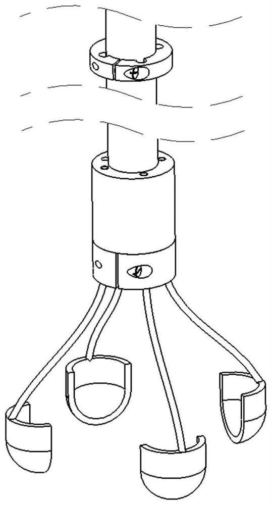 Detachable esophageal foreign matter clamping assistance device under endoscope