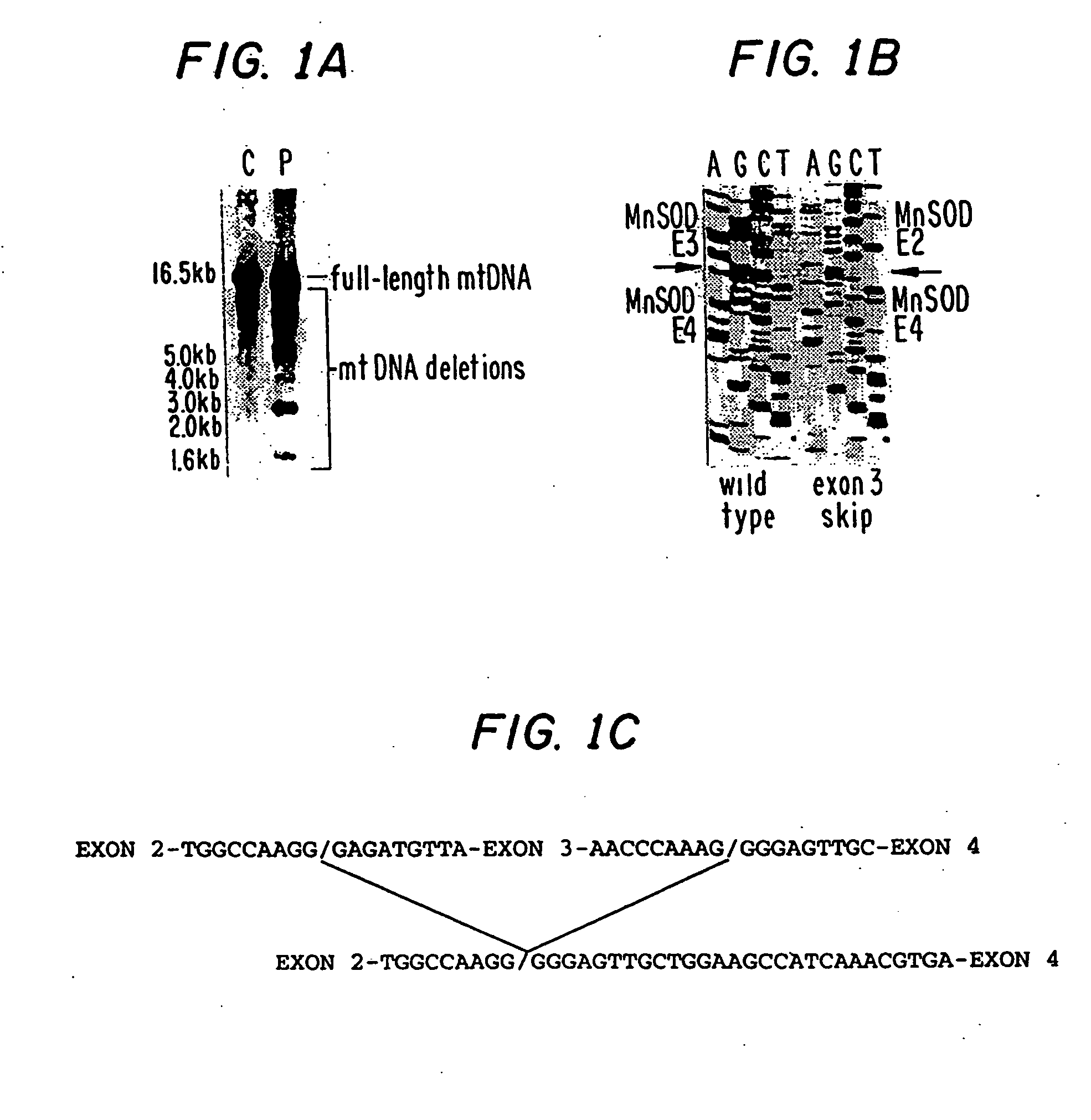 Manganese superoxide dimutase exon 3-deleted isoforms and nucleic acid molecules encoding the isoforms