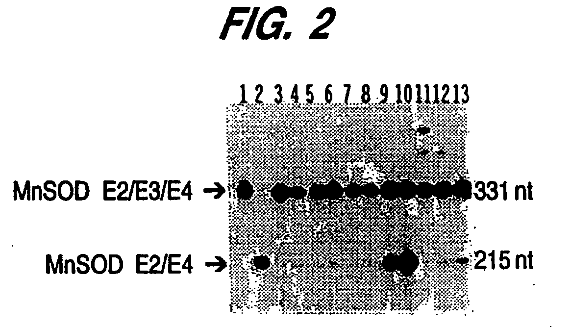 Manganese superoxide dimutase exon 3-deleted isoforms and nucleic acid molecules encoding the isoforms