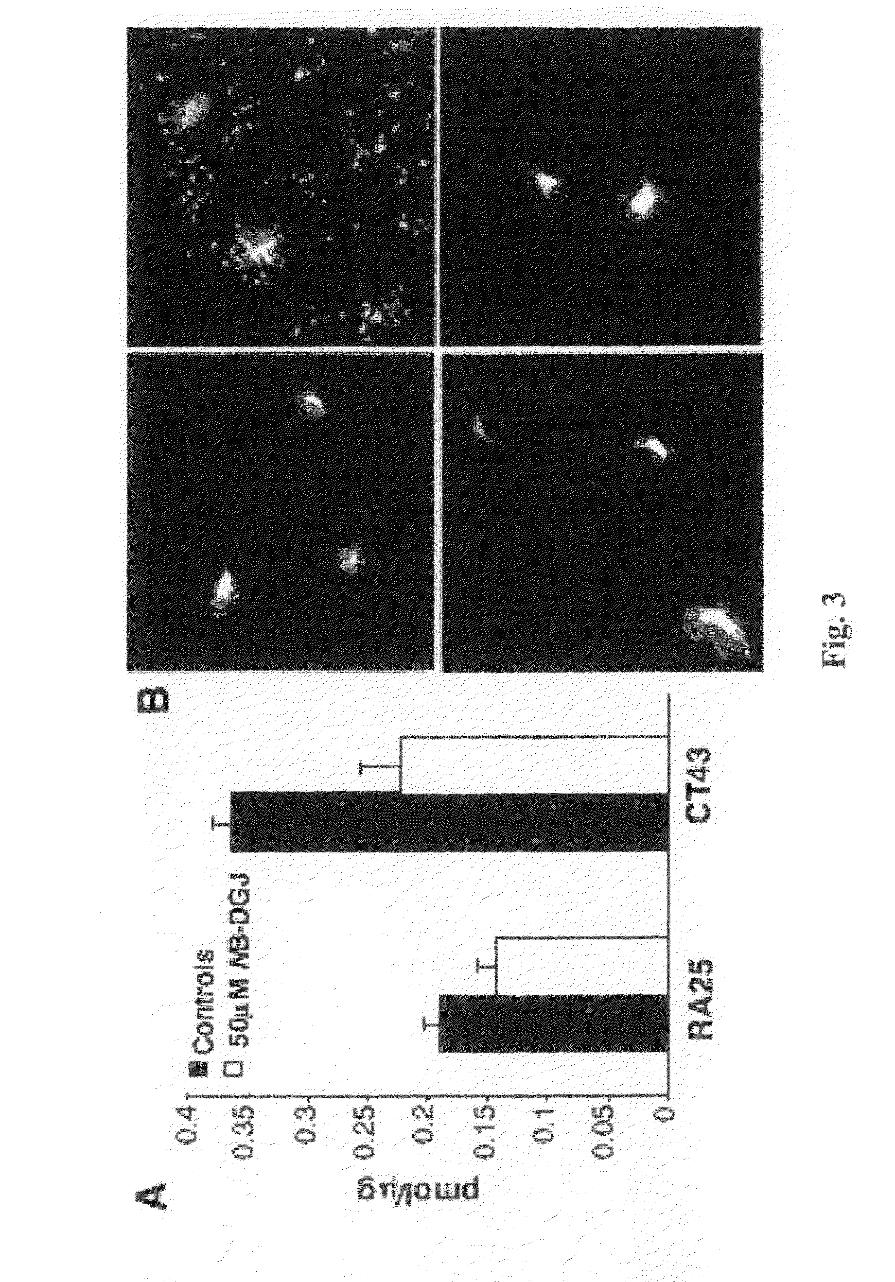 Substrate reduction therapy