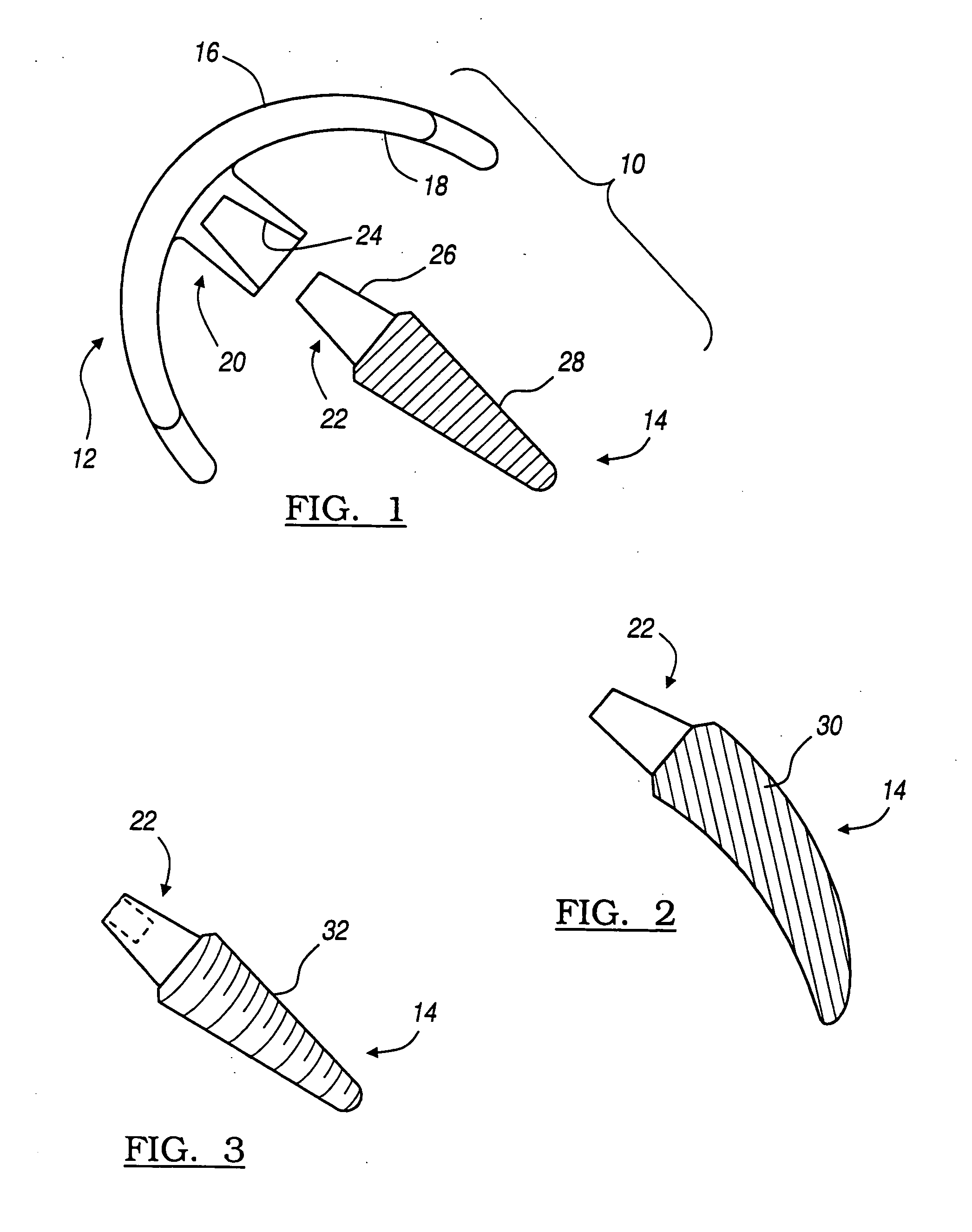 Modular resurfacing prosthetic