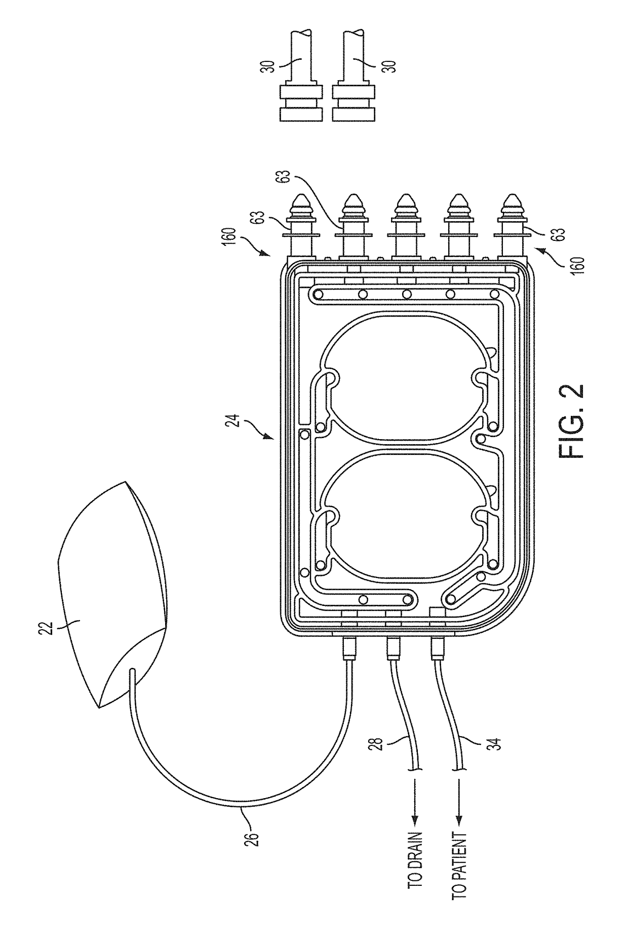 Medical treatment system and methods using a plurality of fluid lines