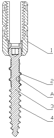 Pedicle screw