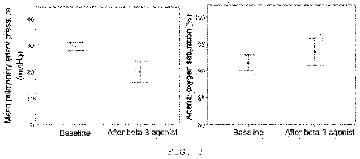 Beta-3 adrenoceptor agonists for the treatment of pulmonary hypertension