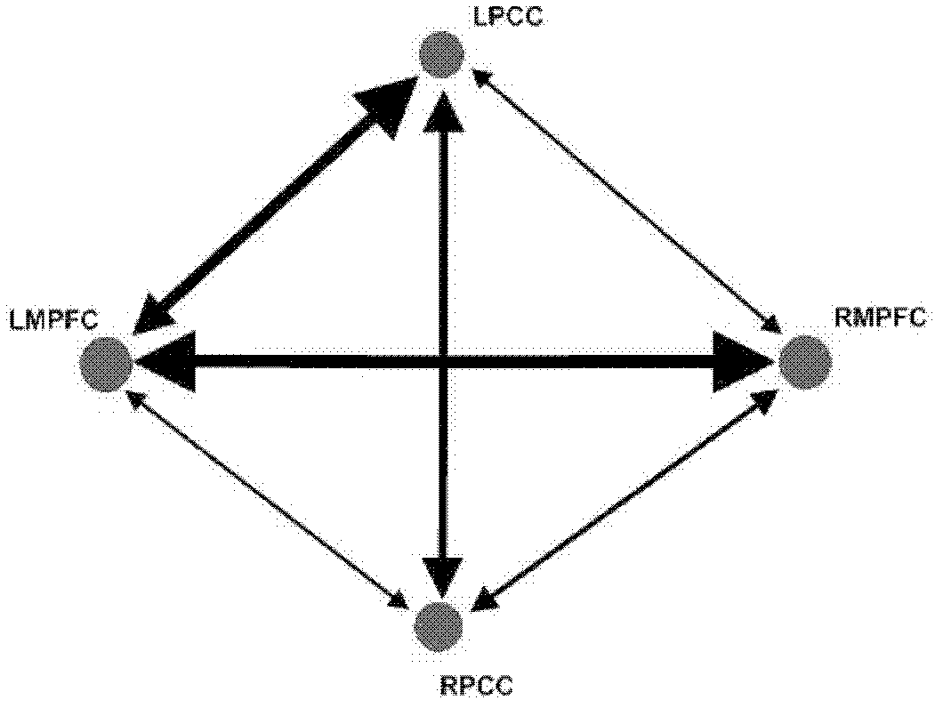 Encephalic region causal connection detection method combining functional magnetic resonance imaging (FMRI) and magnetoencephalography (MEG)