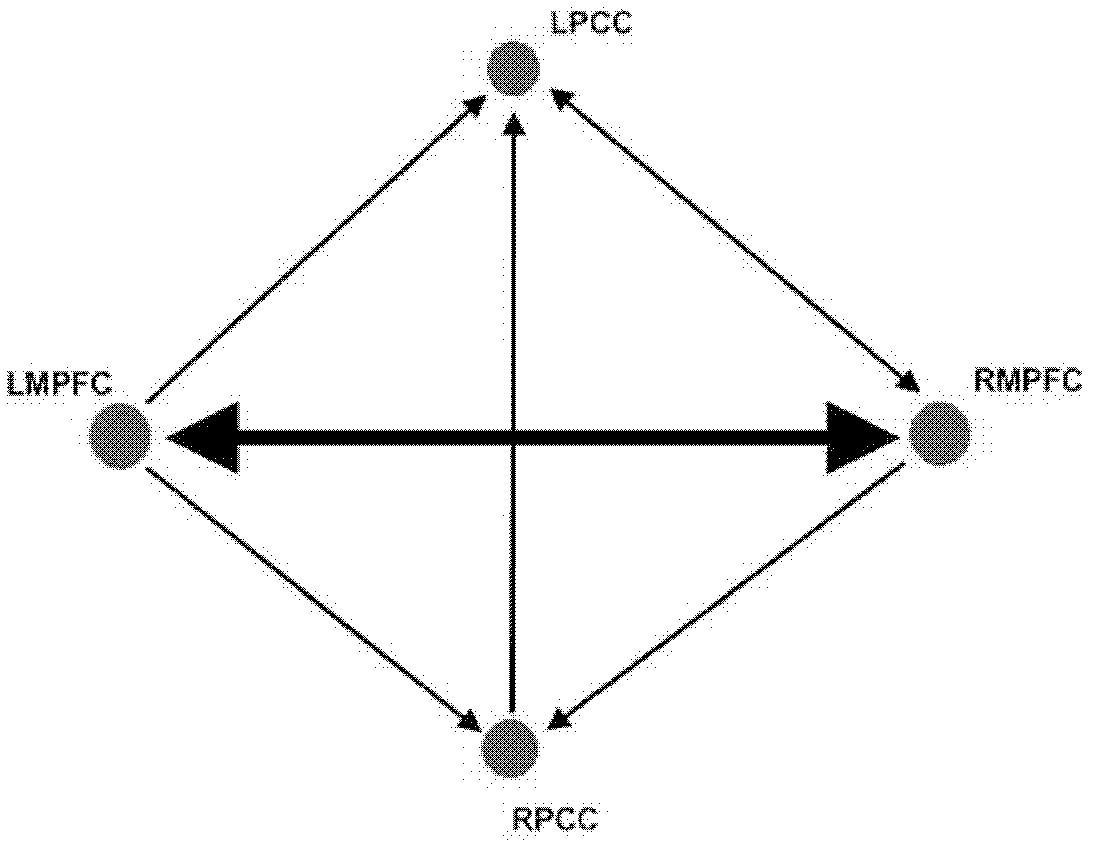 Encephalic region causal connection detection method combining functional magnetic resonance imaging (FMRI) and magnetoencephalography (MEG)