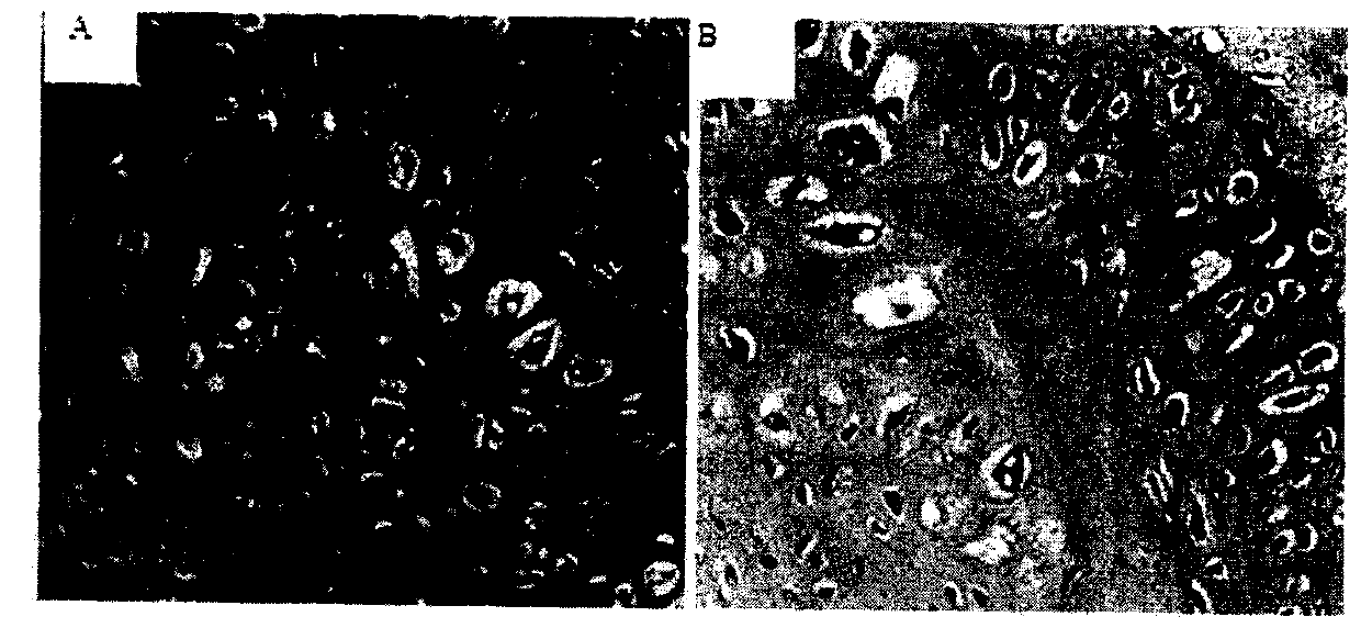 Tissue engineering cartilage and preparation method thereof