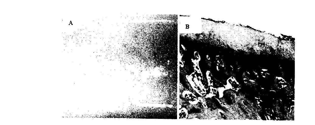 Tissue engineering cartilage and preparation method thereof