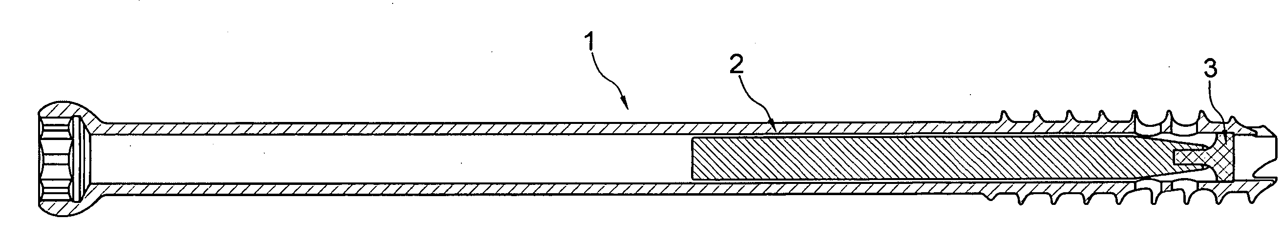 Device for fixation of bone fractures