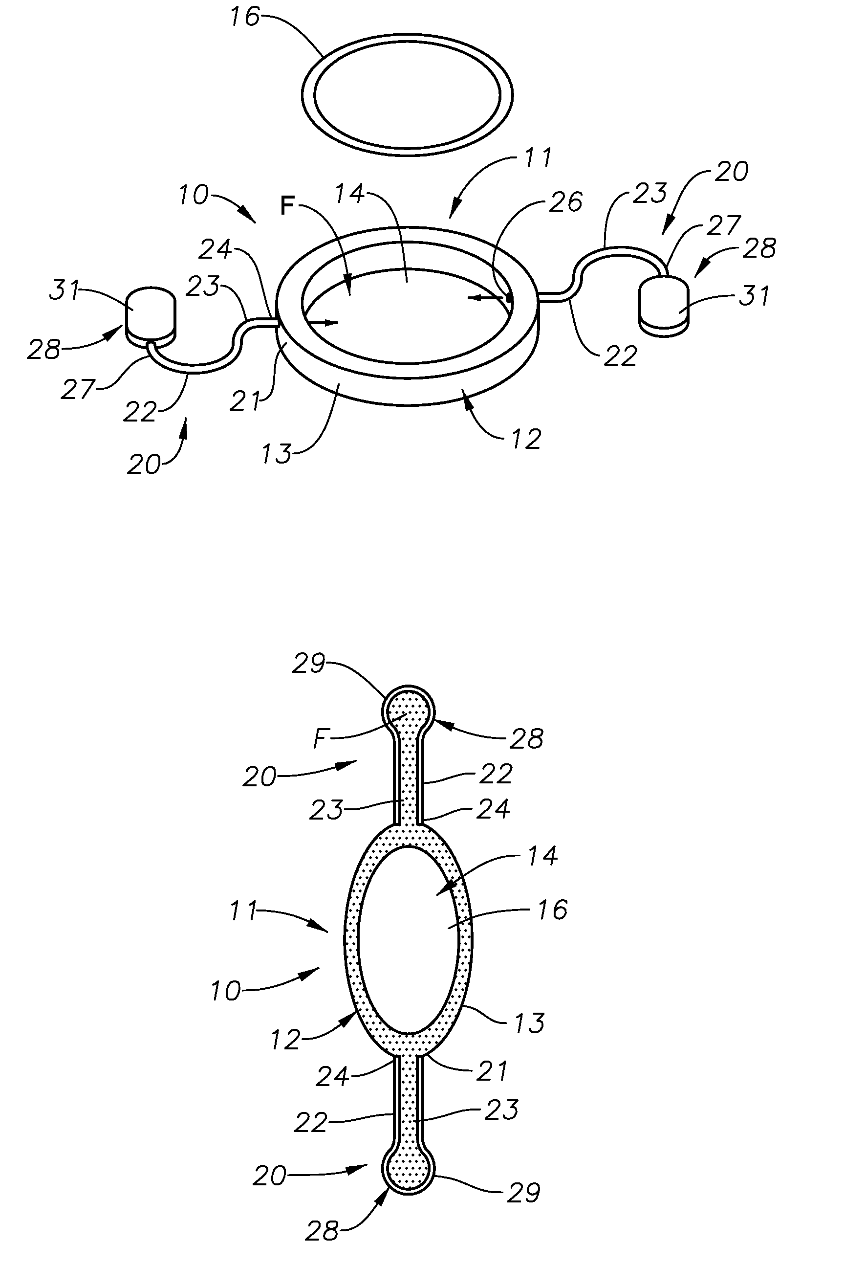 Accommodating intraocular lens