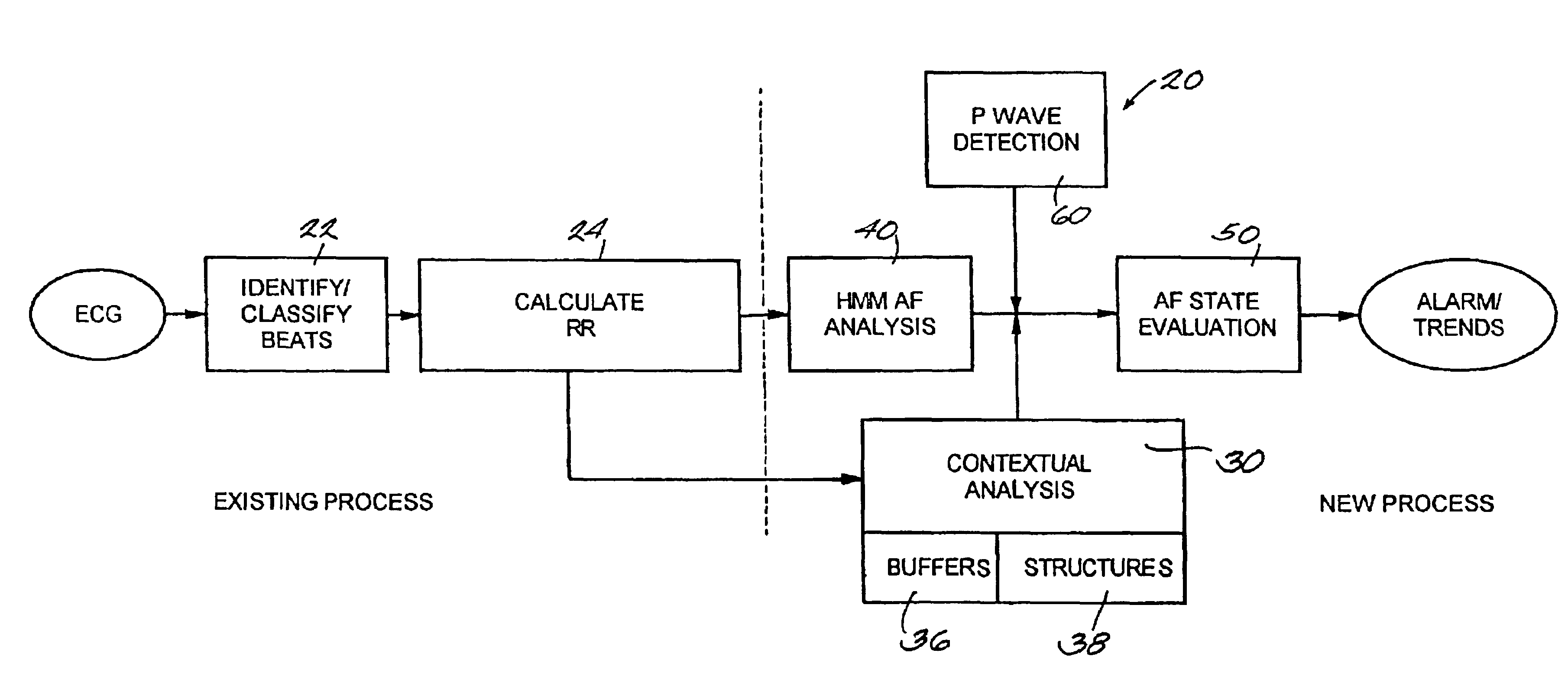 Atrial fibrillation detection method and apparatus