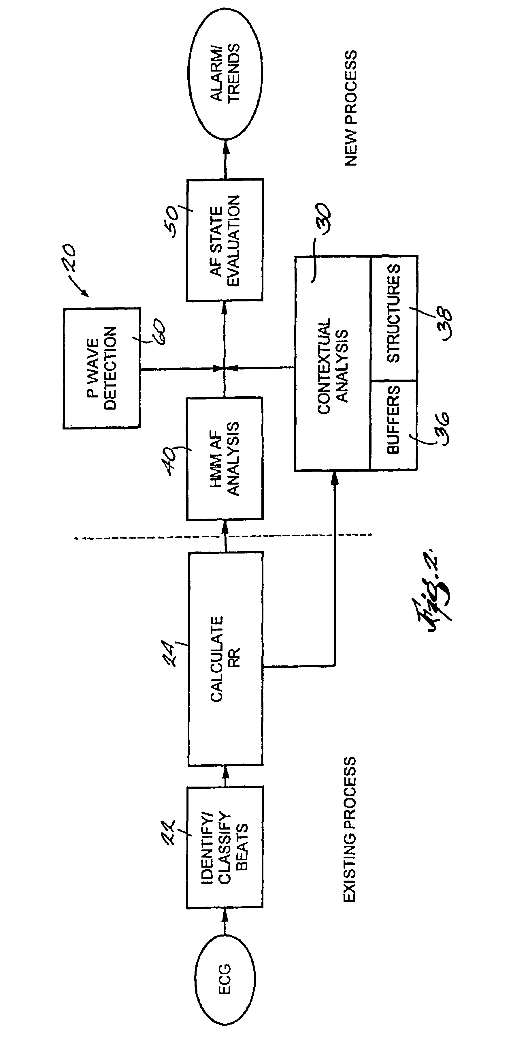 Atrial fibrillation detection method and apparatus