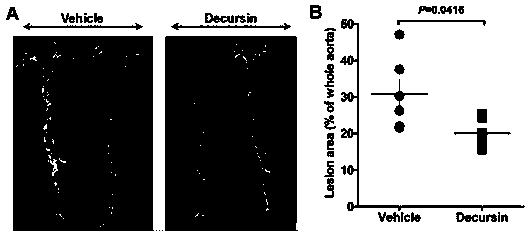 Application of decursinol alpha-angelica lactone to preparation of antiatherosclerosis medicine