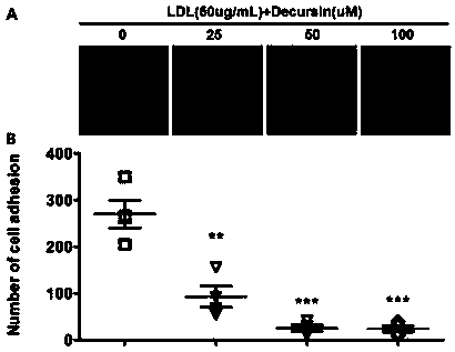 Application of decursinol alpha-angelica lactone to preparation of antiatherosclerosis medicine