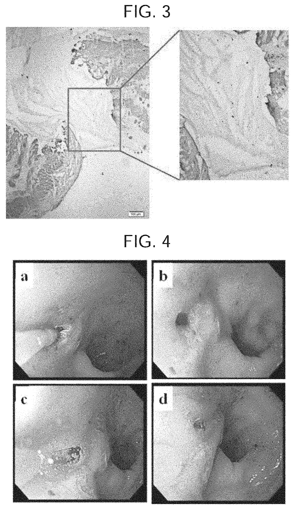 Sol for Occluding Holes in Living Tissue, Protecting Ulcers, and Treating Vascular Embolization