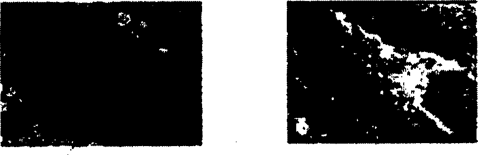 Micro bubble reagent in use for method of blood vessel embolism induced by ultrasonic and method of beauty culture of subtracting fat