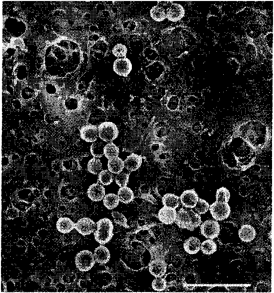 Method for preparing in-situ therapeutic substance-loaded microcapsules