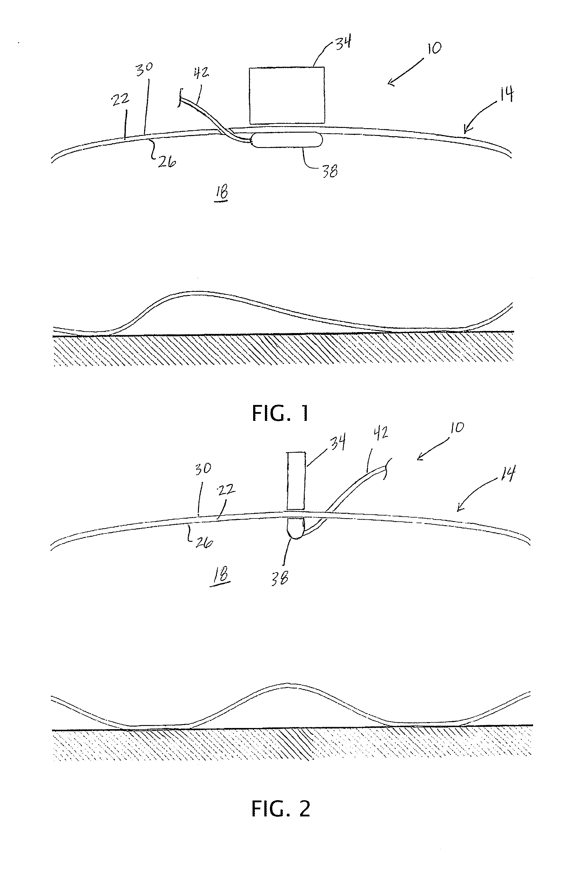 Medical Devices, Apparatuses, Systems, and Methods with Magnetic Shielding