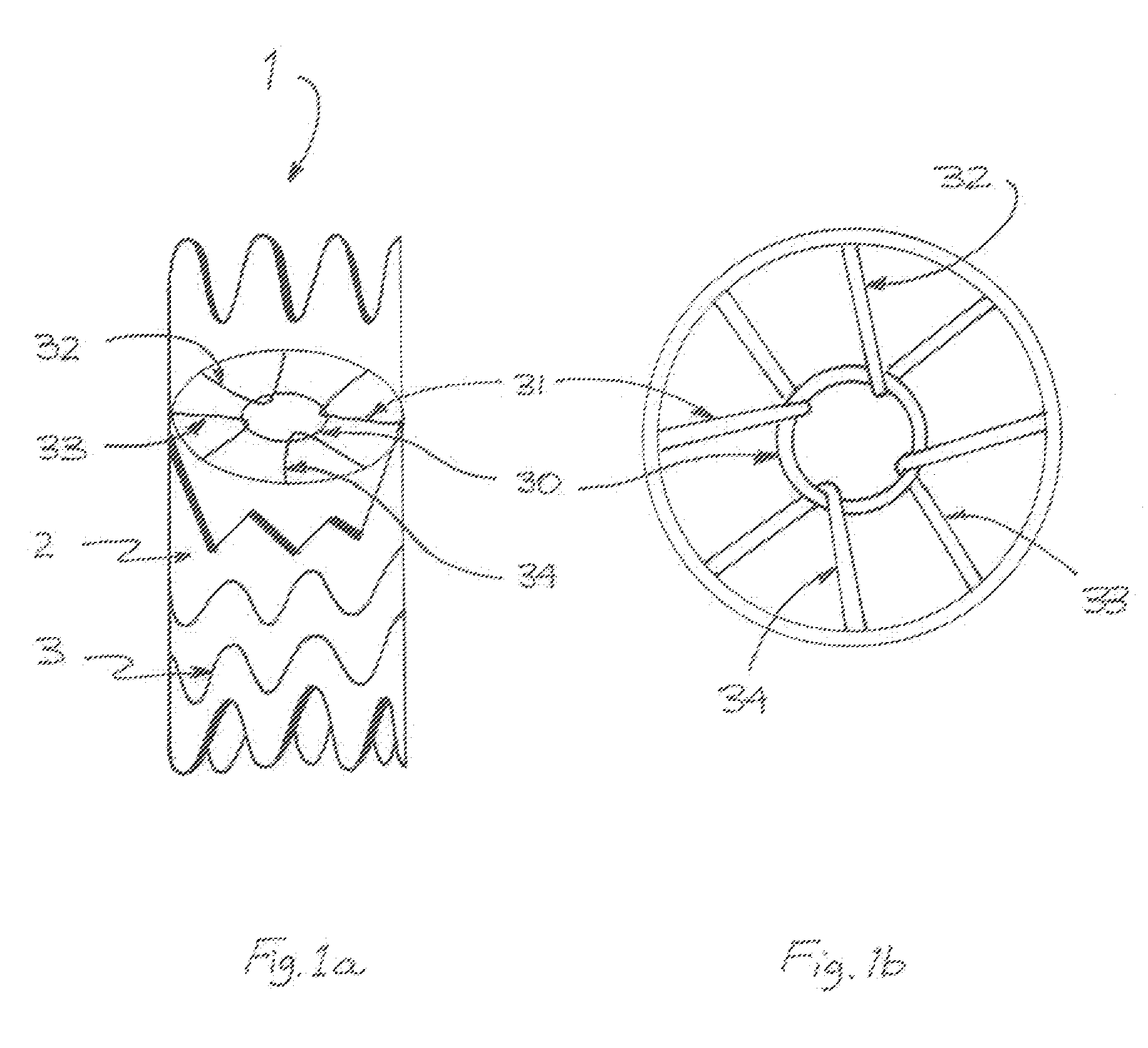 Vascular Filter Stent