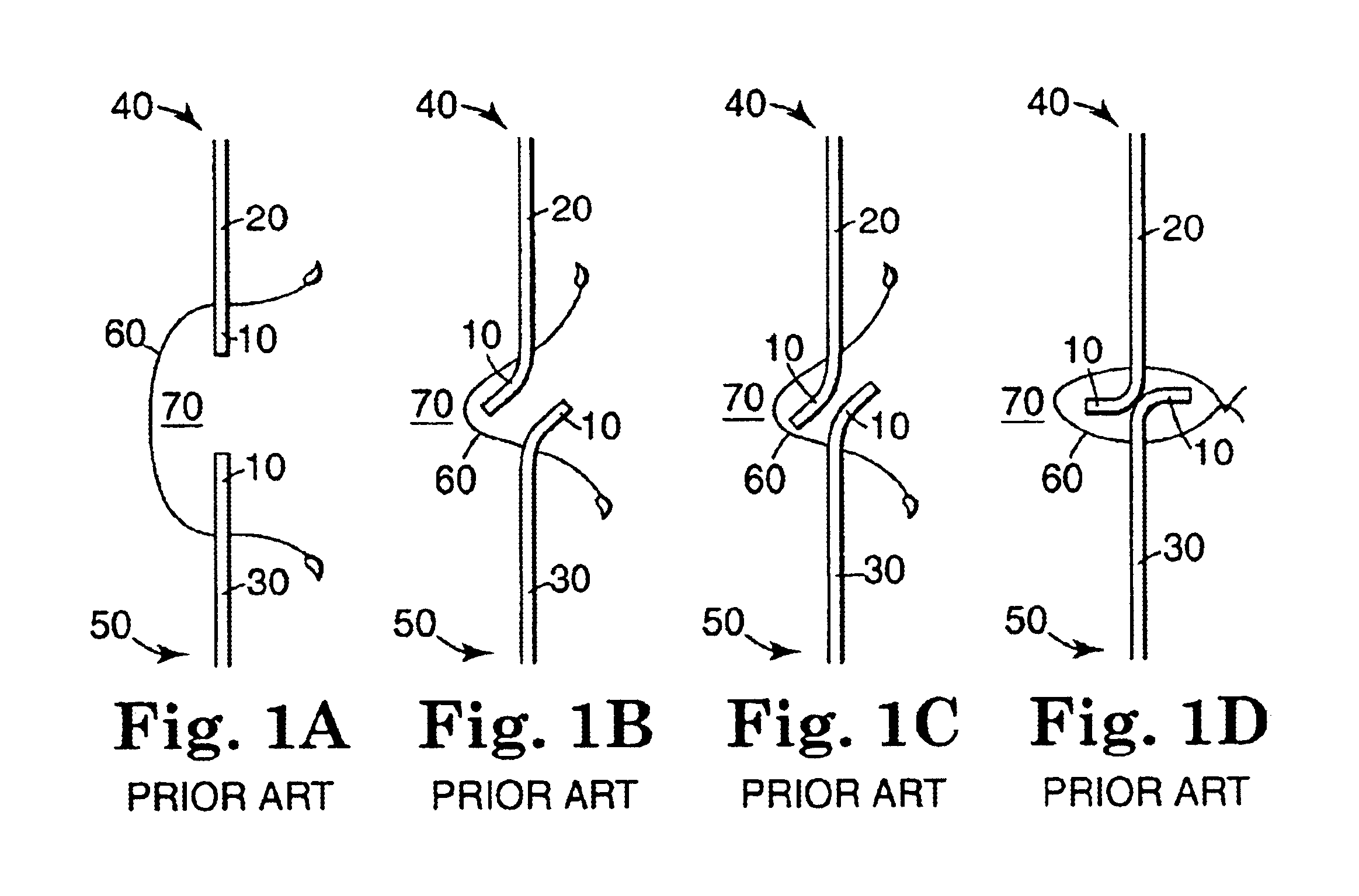 Device for creating an anastomosis, including penetration structure and eversion structure