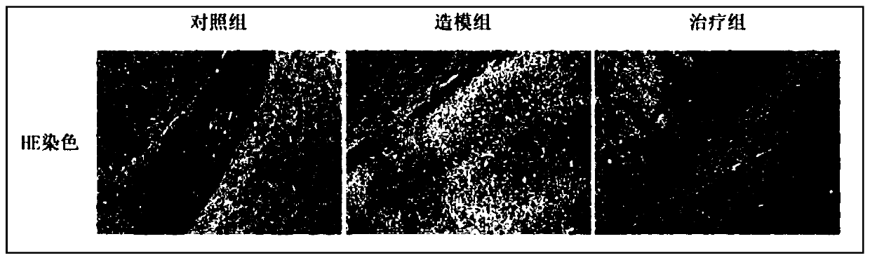 Application of glutathione (GSH) to preparation of drug for preventing and treating central nervous system infection caused by salmonella typhimurium