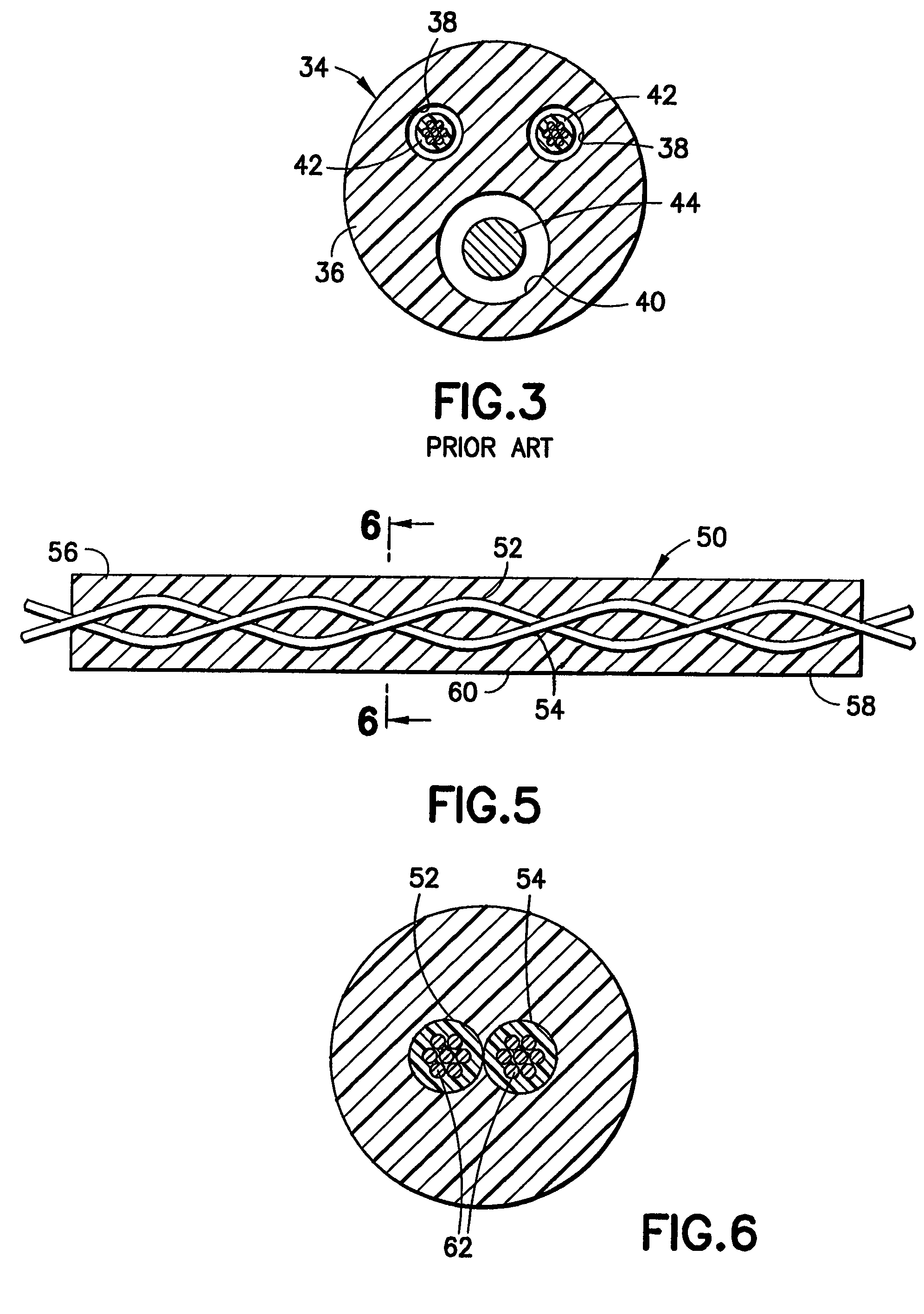 Construction of a medical electrical lead