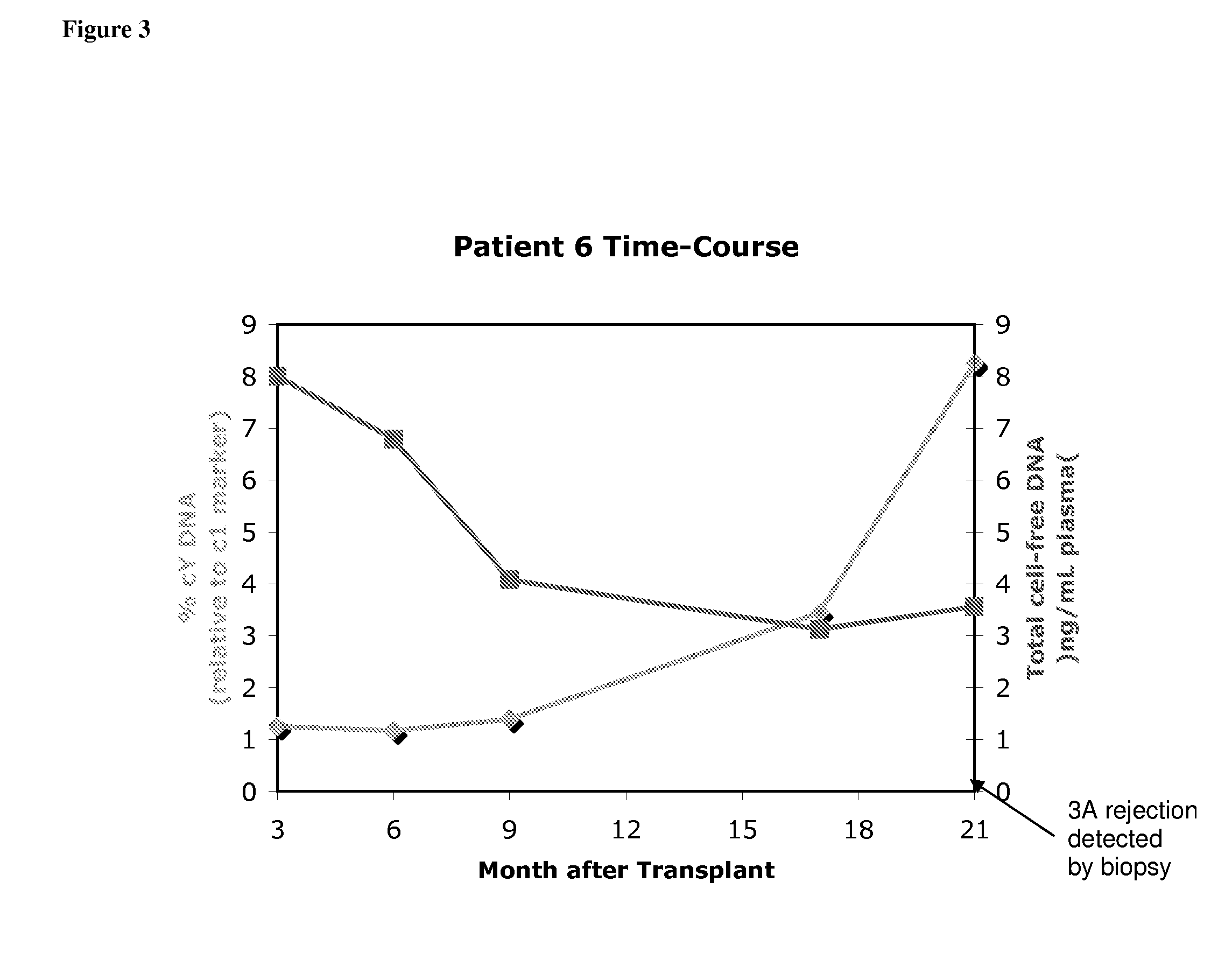 Non-invasive diagnosis of graft rejection in organ transplant patients