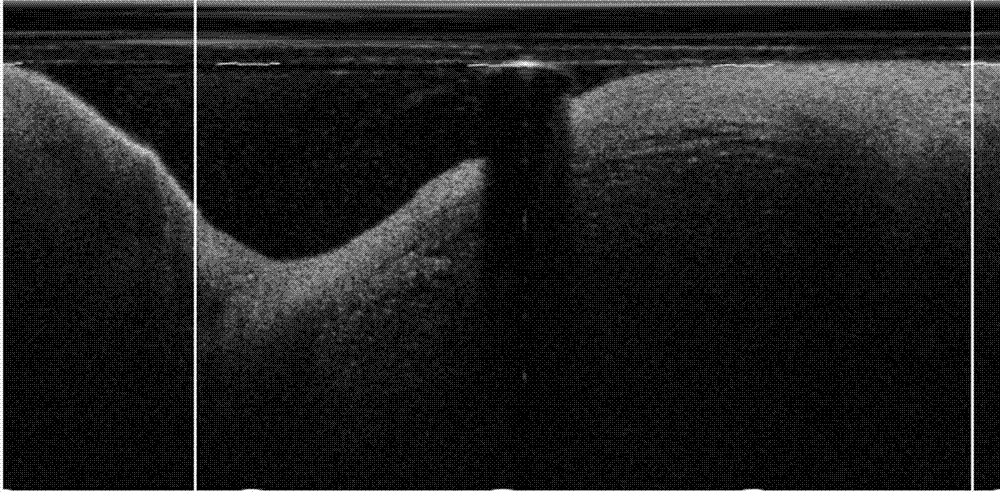 Automatic identification method of vulnerable plaques of cardiovascular optical-coherence-tomography (OCT) image