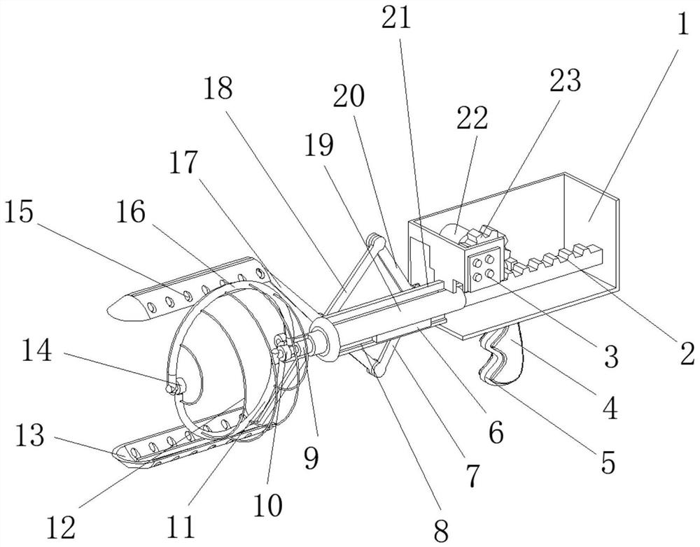 A new type of stone removal device used in clinical hepatobiliary surgery