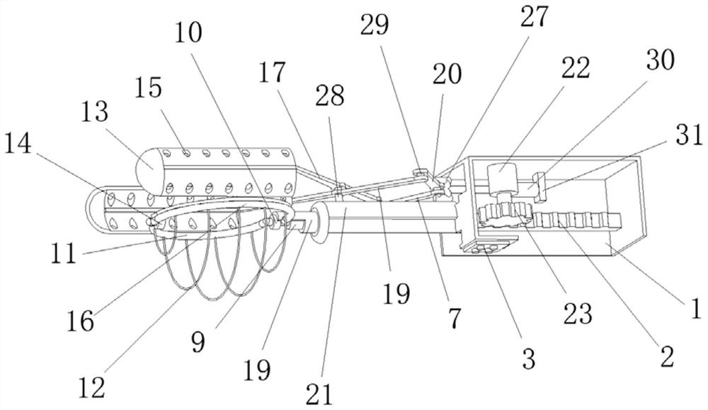 A new type of stone removal device used in clinical hepatobiliary surgery