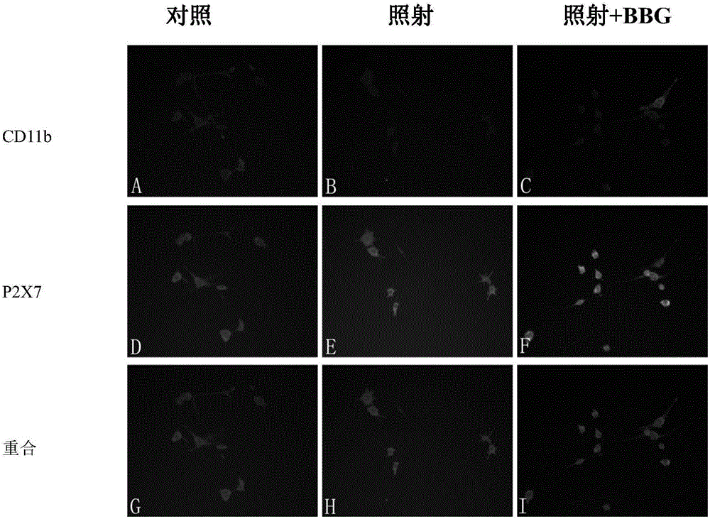 Application of P2X7 receptor inhibitor