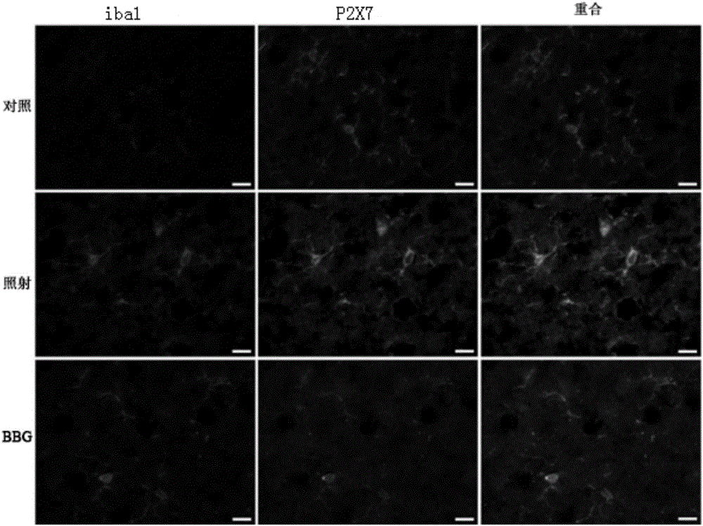 Application of P2X7 receptor inhibitor