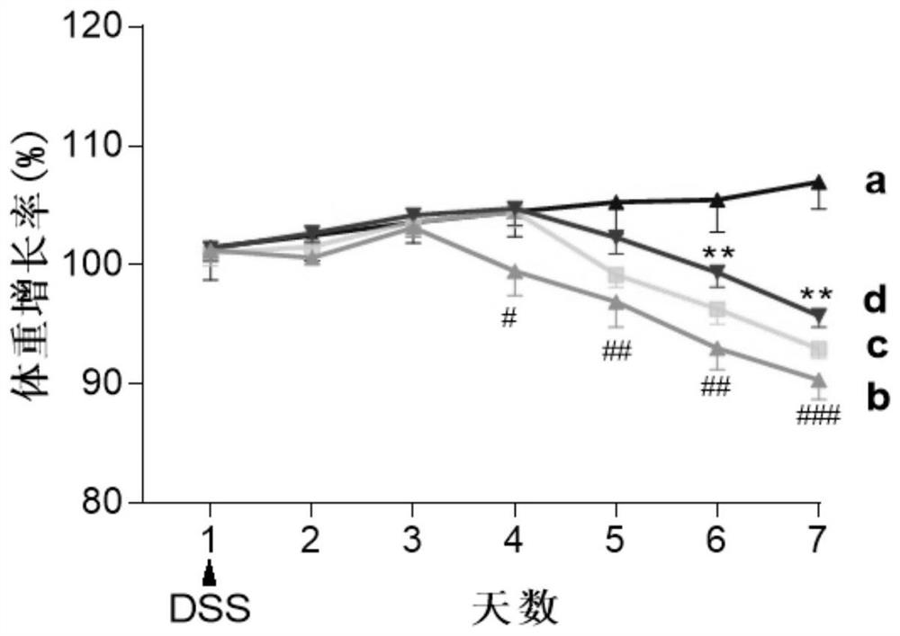 Application of fangchinoline in preparation of medicine for preventing and treating ulcerative colitis