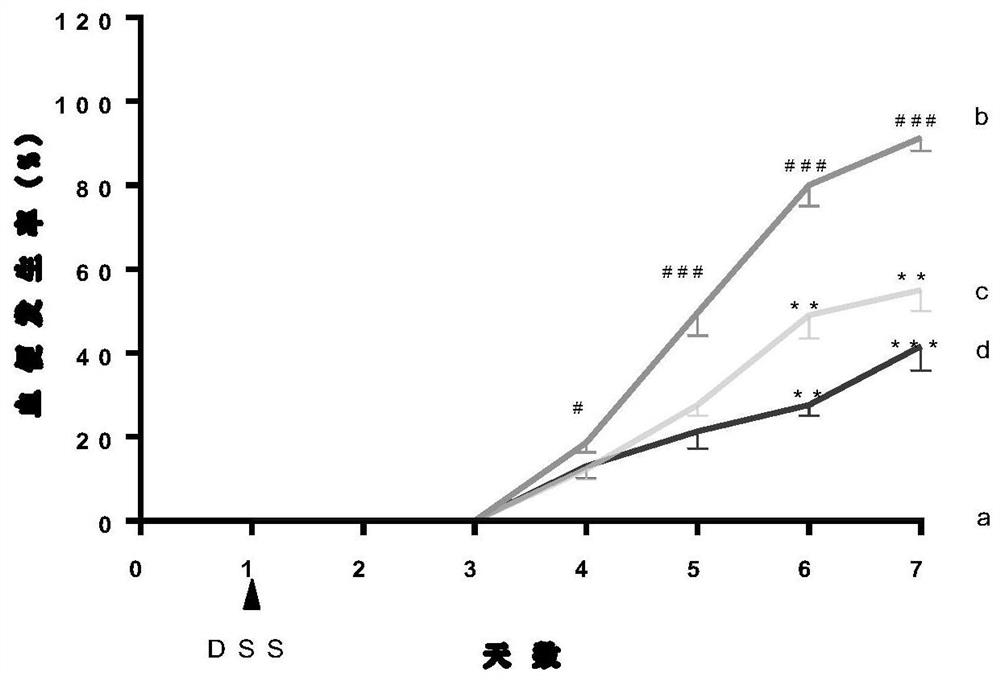 Application of fangchinoline in preparation of medicine for preventing and treating ulcerative colitis