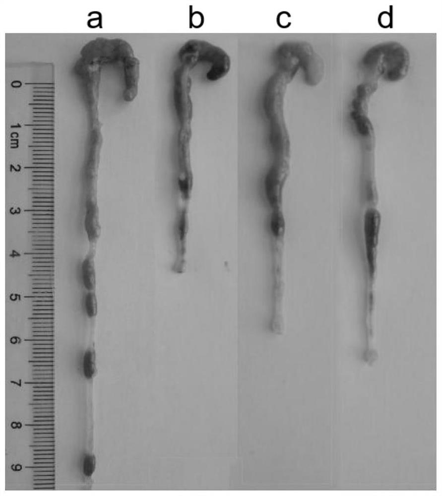 Application of fangchinoline in preparation of medicine for preventing and treating ulcerative colitis